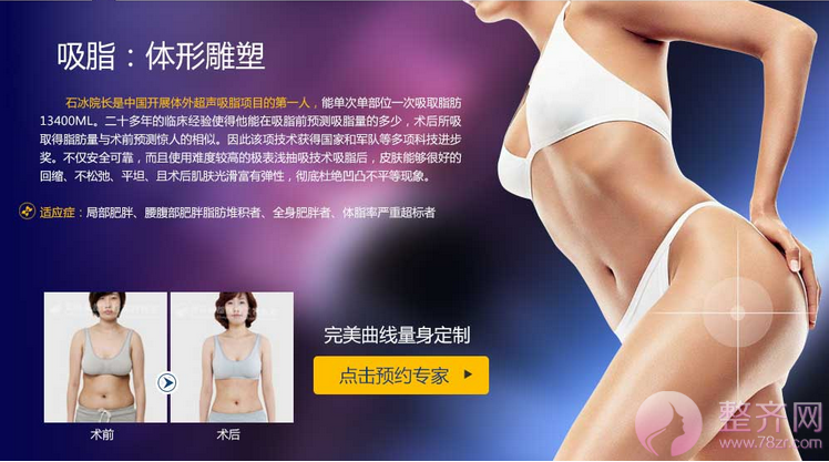 北京丽都石冰吸脂塑形怎么样?