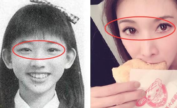 双眼皮留疤恐怖吗?怎么处理?