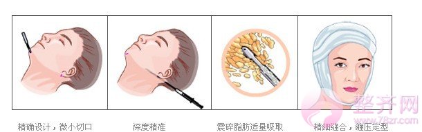 如何解决你的双下巴?