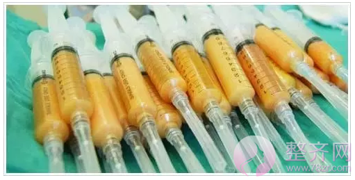 自体脂肪移植为何如此受欢迎?