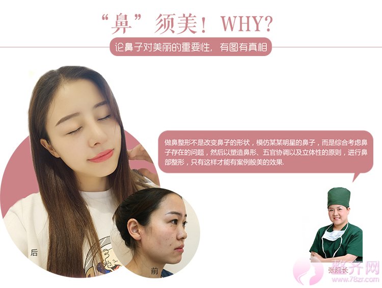 什么样的鼻子才好看?