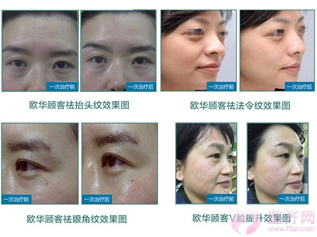你辣么美,究竟用了什么驻颜术?