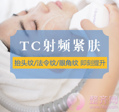 你辣么美,究竟用了什么驻颜术?