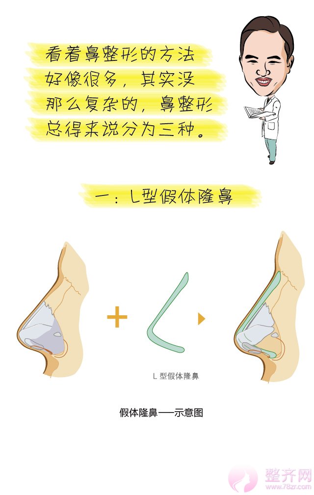 巫文云隆鼻观,鼻整形大讲堂