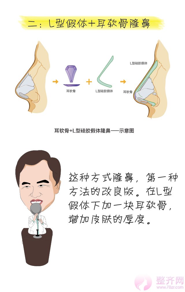 巫文云隆鼻观,鼻整形大讲堂