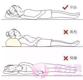 假体隆胸手感硬还不能剧烈运动?No!