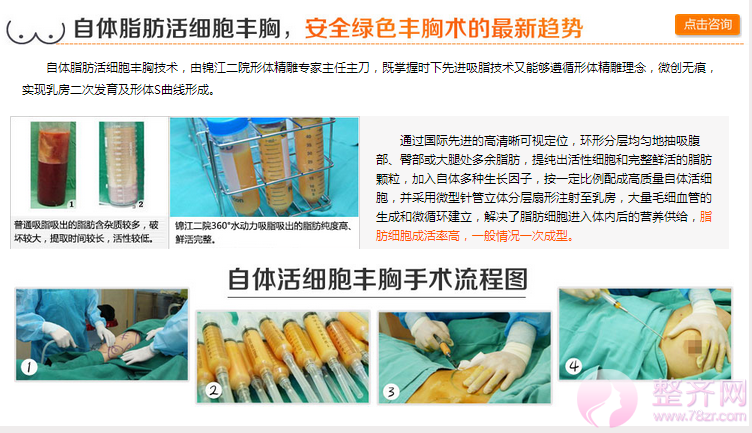 北京天使名源自体脂肪隆胸怎么样?