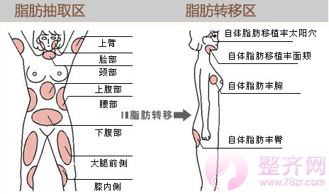 脂肪填充让你拥有童颜!