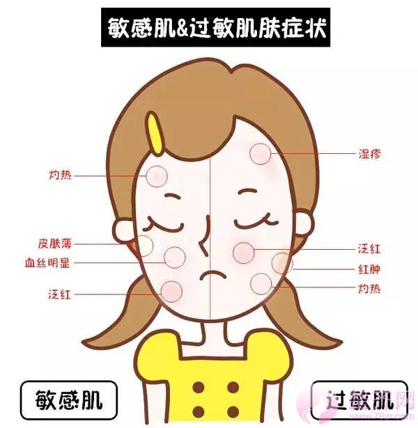 脸部红血丝泛滥应该怎么改善?