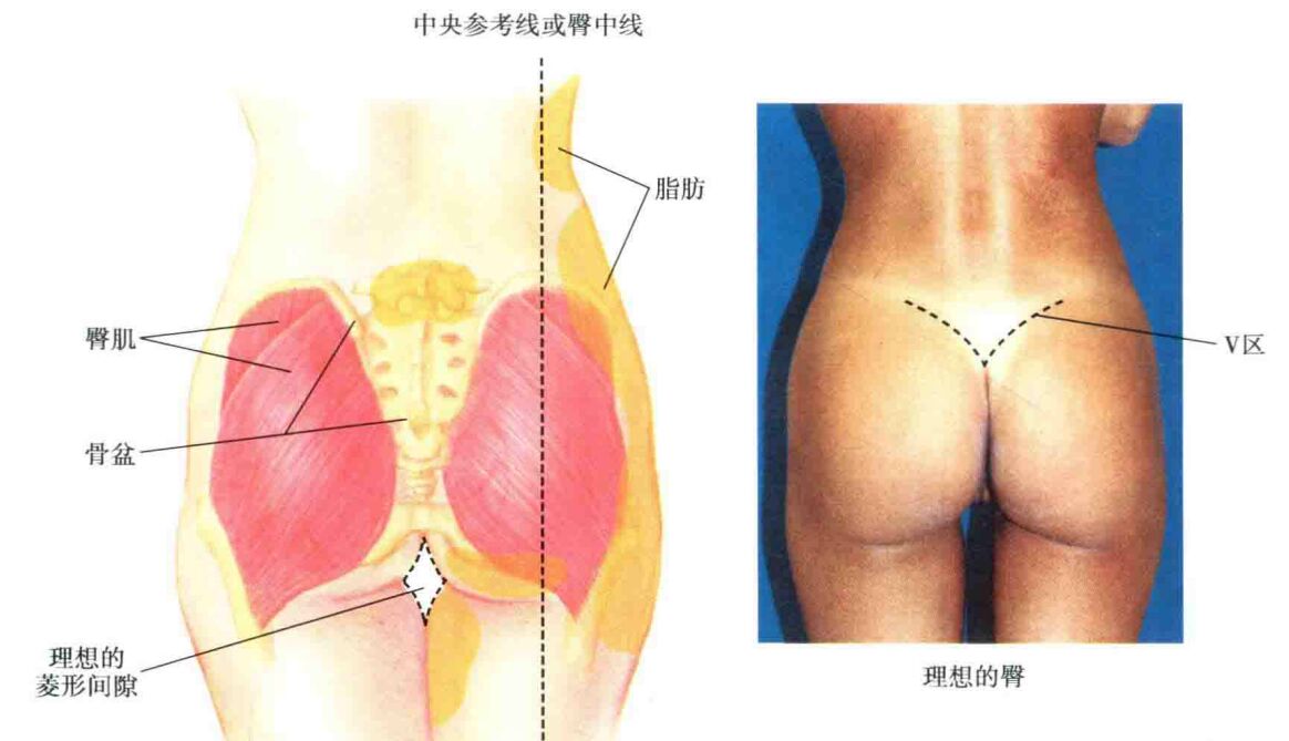 哪些人适合做丰臀,怎样的臀部才好看?
