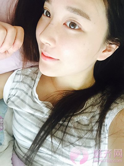 自体脂肪面部移植,硅胶隆鼻案例