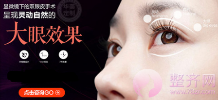 4种标准双眼皮,你做哪种?