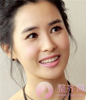 4种标准双眼皮,你做哪种?