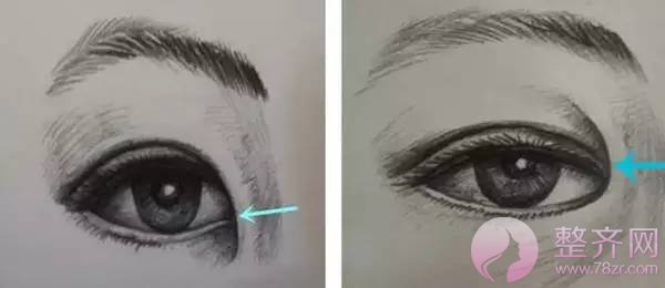 欧式双眼皮,到底美在哪里?