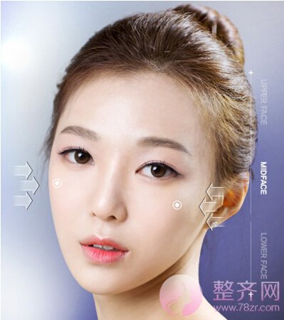 “无下垂颧骨移动术”,韩国妹子为啥都是小半