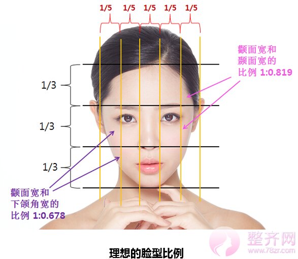 “无下垂颧骨移动术”,韩国妹子为啥都是小半