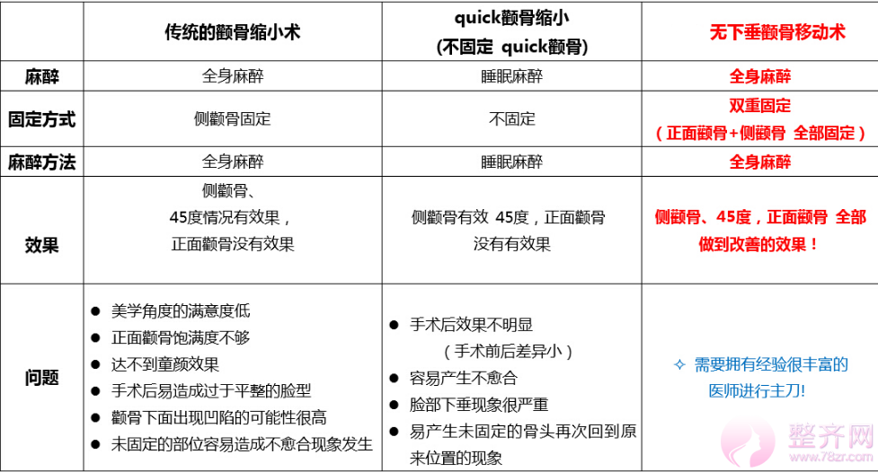 什么是无下垂颧骨移动术?