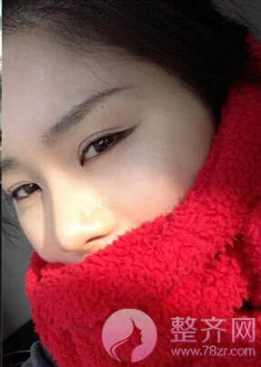 不要拒绝整形,颜值和变美的方式无关