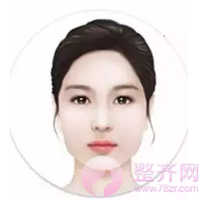 改脸型整形术适合哪些脸型?
