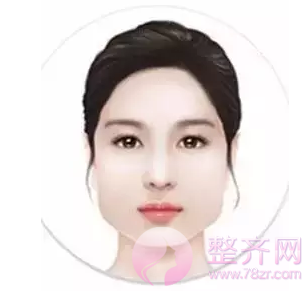 改脸型整形术适合哪些脸型?