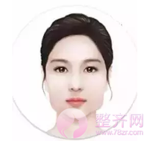 改脸型整形术适合哪些脸型?