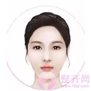 改脸型整形术适合哪些脸型?