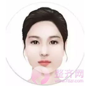 改脸型整形术适合哪些脸型?