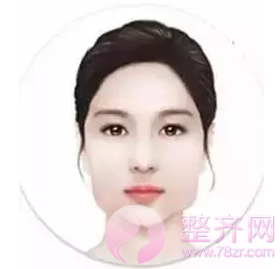 改脸型整形术适合哪些脸型?