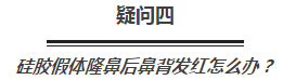 玻尿酸、假体、软骨,隆鼻选哪种更好?