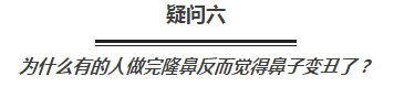 玻尿酸、假体、软骨,隆鼻选哪种更好?