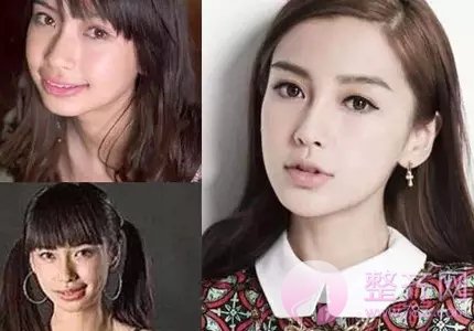 什么样的牙齿需要做正畸呢?