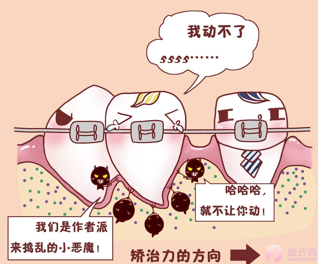 什么样的牙齿需要做正畸呢?