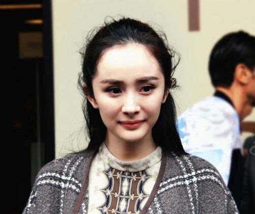 杨幂发际线又被吐槽 真的需要植发吗?