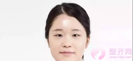 单眼皮和双眼皮的区别是什么?