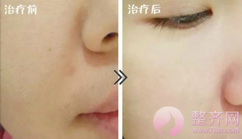 水光补水不仅仅只是微整!