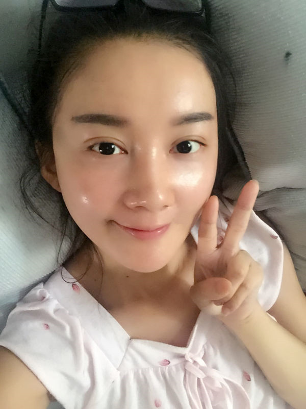 北京鹏爱医疗美容医院丰额头的价格是多少?