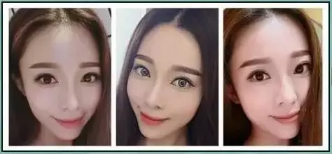 整形真的会有“整形癖”?