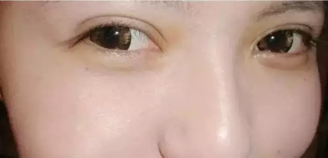 整形真的会有“整形癖”?