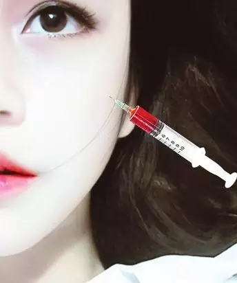 整形真的会有“整形癖”?