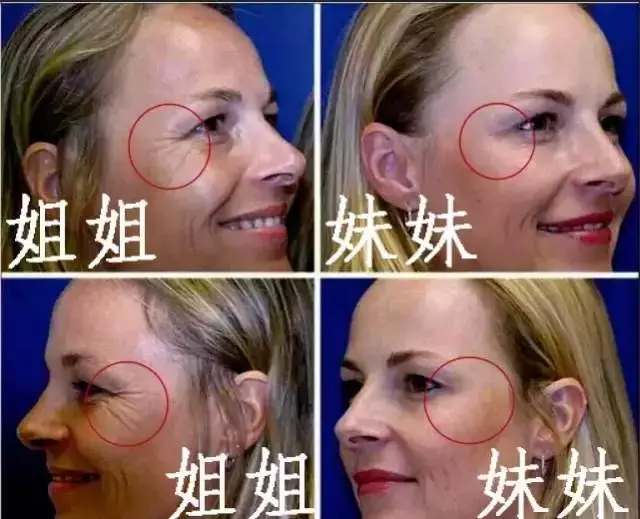 整形真的会有“整形癖”?
