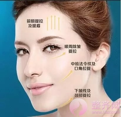 超声提拉+埋线提升让岁月无限延缓!