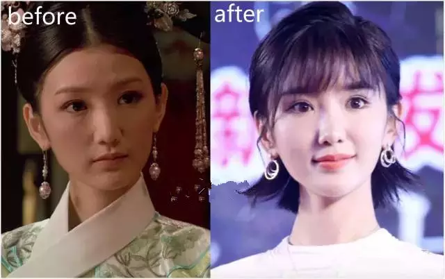 面部松弛毁所有,女神如何抗“老”