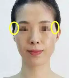 面部松弛毁所有,女神如何抗“老”