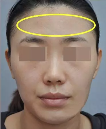 面部松弛毁所有,女神如何抗“老”