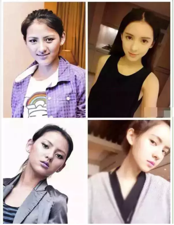 面部松弛毁所有,女神如何抗“老”