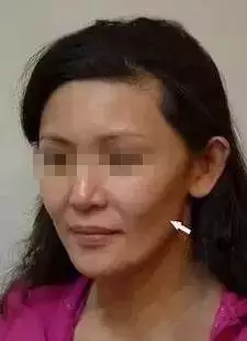 面部松弛毁所有,女神如何抗“老”