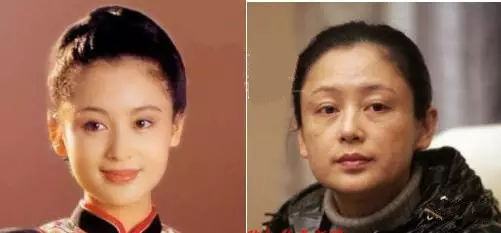面部松弛毁所有,女神如何抗“老”