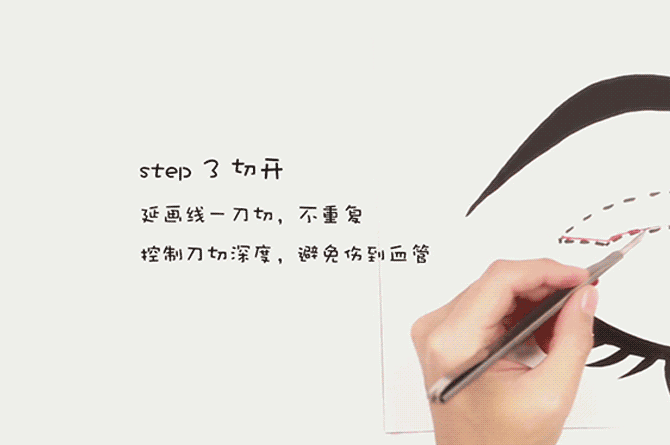 做双眼皮你怕了么!!!