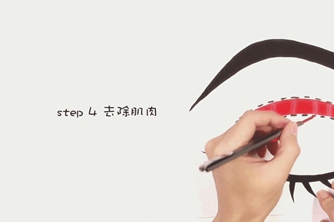 做双眼皮你怕了么!!!