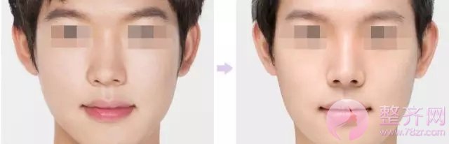 在这个看脸的时代,鼻子才是重要指标